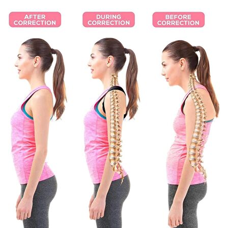 Medikal Korse Ayarlanabilir Dik Duruş Korsesi Ortopedik Kifoz Sırt Korsesi Gerdirici Korse Sırt Ağrısı İçin Korse