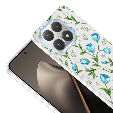 Xiaomi 15T Uyumlu Kılıf Desenli Kapak Zr-Klip