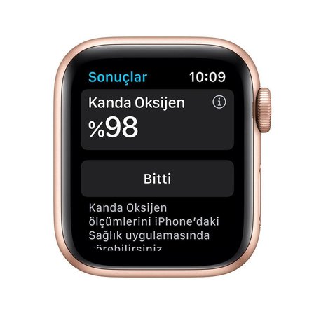 Apple Watch Seri 6 40mm (GPS) Alüminyum Kasa Altın - Yenilio Yenilisi - A Kalite - MG123TU/A