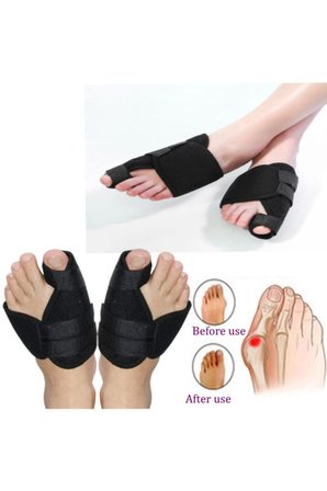Halluks Valgus Gece Ateli Ayak Baş Parmak Kemik Çıkıntısı Düzeltici Bunyon Tedavisi
