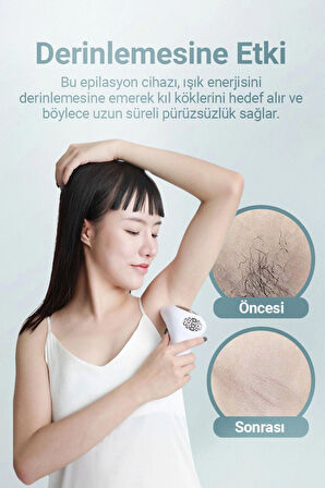 Epilasyon Cihazı / IPL Buz Lazer 900000 Atım TF-001 