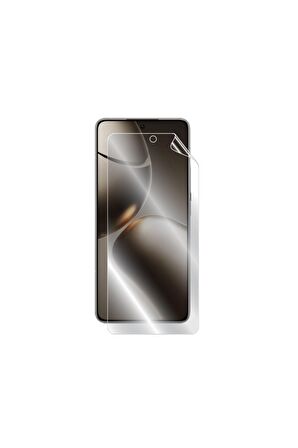 Xiaomi 14T Pro için IPG Hydrogel Ekran Koruyucu