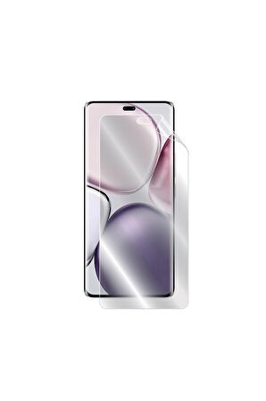 Honor Magic 7 Lite Için Hydrogel Ekran Koruyucu