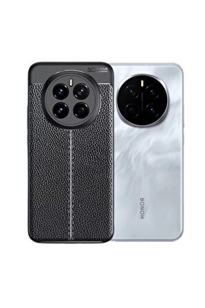Honor Magic 7 Pro Uyumlu Silikon Kılıf Deri Desenli Kamera Korumalı Darbe Emici Autofocus Kapak