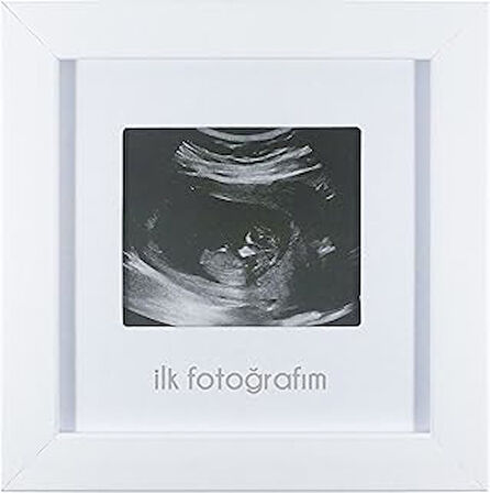 Fufi̇zu İlk Fotoğrafım Bebek Ultrason Çerçevesi - Bebek Odası Resim Anı Çerçevesi