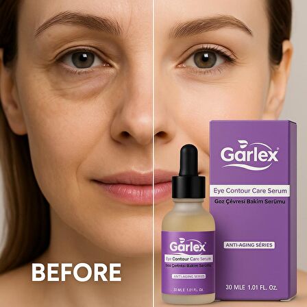 Garlex Göz Çevresi Bakım Serumu 30ml – Kırışıklık Karşıtı, Morluk Giderici, Kolajen Destekli Anti-Aging Serum