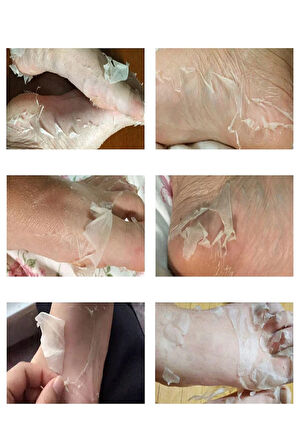 Ayak Peeling Maskesi – Nasır, Ölü Deri, Giderici, Nemlendirici Lavanta Özlü Maske