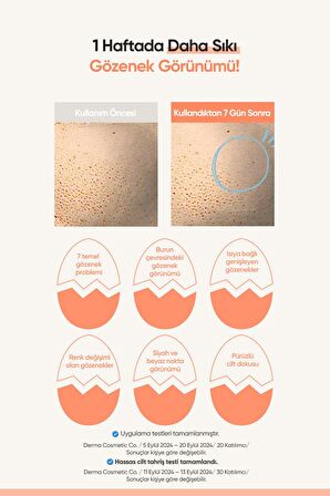 Cilde Aydınlık ve Pürüzsüz Görünüm Kazandıran Gözenek Karşıtı Serum A'PIEU Egg Pha Pore Serum