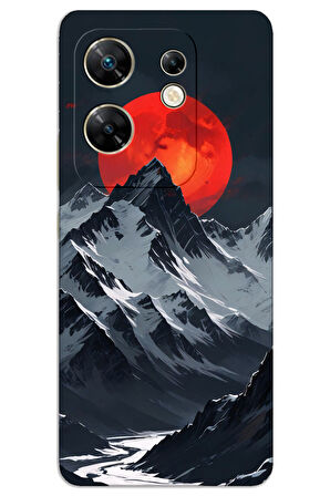 İnfinix Zero 30 Kılıf HD Desen Baskılı Kılıf - 5722
