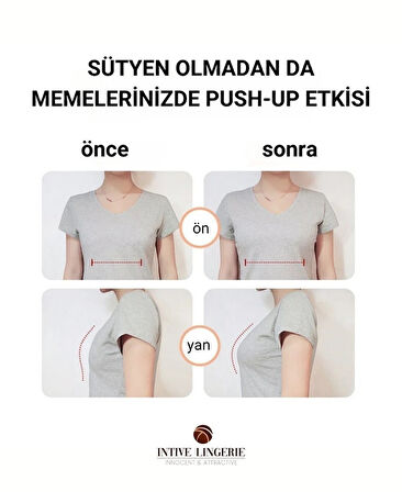 Intive Kadın Silikon Ten Rengi Çiçek Şekilli Meme Dikleştirici Göğüs Asansörü/Kapatıcı