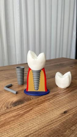 İmplant Modeli Diş Hekimliği Eğitici Model 