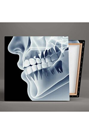 Diş Sağlığı Dişçi Diş Hekimi Çene Röntgeni Dentist Kanvas Tablo T3032212