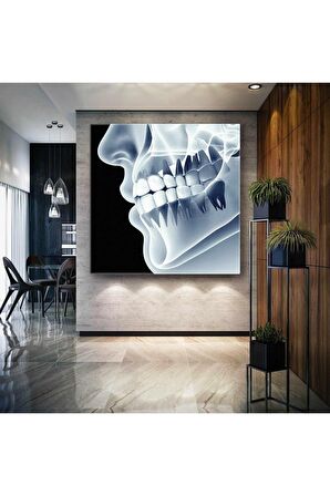 Diş Sağlığı Dişçi Diş Hekimi Çene Röntgeni Dentist Kanvas Tablo T3032212