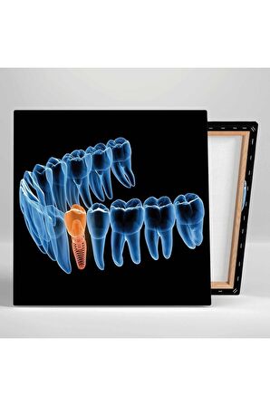 Dişçi Diş Hekimi Ofisi Gülüş Tasarımı Dentist Kanvas Tablo T