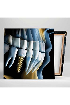 Diş Hekimi Ofisi Gold Implant Ağız Ve Diş Sağlığı Kanvas Tablo T