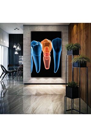 Ağız Ve Diş Sağlığı Implant Dişçi Ofis Kanvas Tablo T