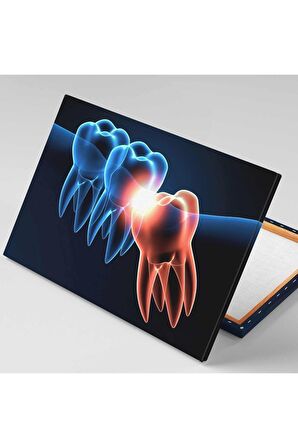 Ağız Diş Sağlığı Dişçi Diş Hekimi Lik Dentist Kanvas Tablo T