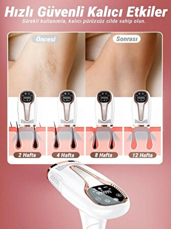 TF Epilasyon Cihazı / IPL Buz Lazer Epilasyon Cihazı  999.999 Atım TF-002