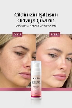 leke bakım kremi %4 tranexamic acid arbutin kojic dipalmitate 50 ml cilt tonu eşitleyici bakım