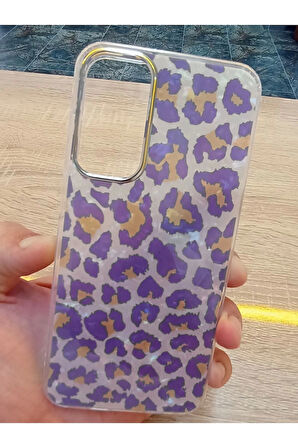 Samsung Galaxy A35 Leopar Desen Hologramlı Kılıf Darbe Korumalı Kapak