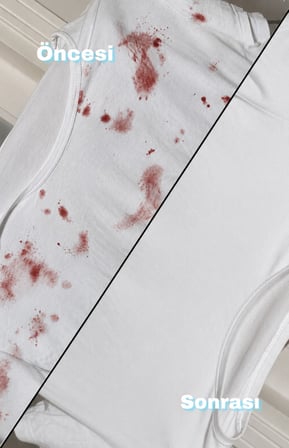 sodyum perkarbonat 1 kg 2 adet avantaj paketi– oksijen bazlı leke çıkarıcı, beyazlatıcı ve çamaşır temizleme tozu, i̇natçı lekeler için