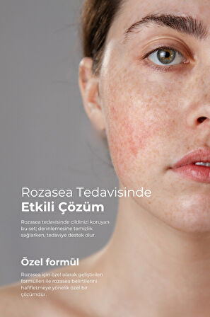 TTO Rozasea Başlangıç Seti 2 