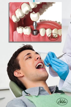 Tekli, Yatay, Kanvas, Dekoratif, Duvar, Tablosu , Ağız Ve Diş Sağlığı, Dişçi, Poliklink,