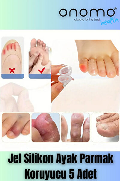 Onomo Nasır Önleme