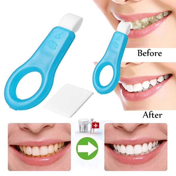 Lisinya Diş Parlatıcı, Beyazlatıcı