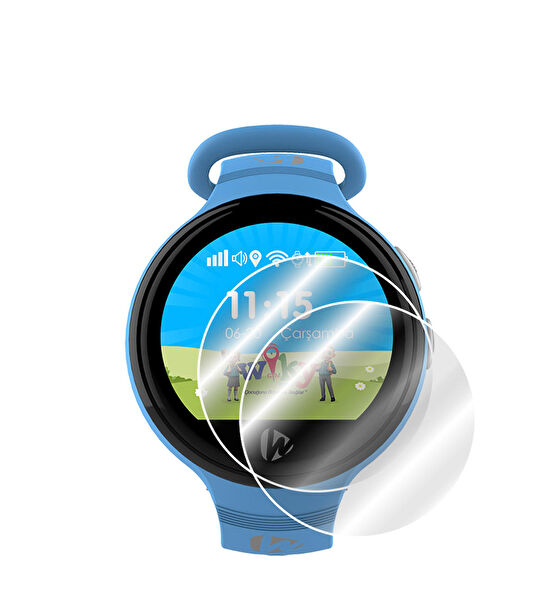 IPG Akıllı Saat Aksesuar