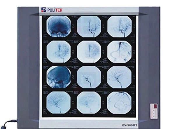 Politek Alın Aynası, Medikal Işık Kaynakları