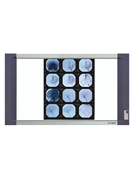 Politek Alın Aynası, Medikal Işık Kaynakları