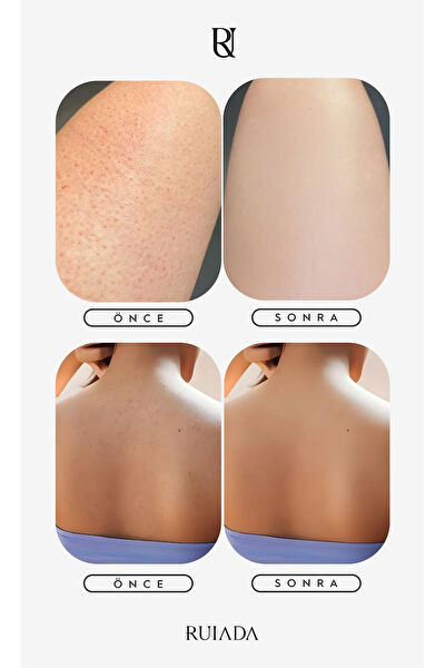 RU RUIADA Banyo Lifi, Süngeri