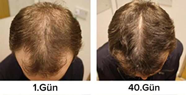 Purexpose Saç Serumu