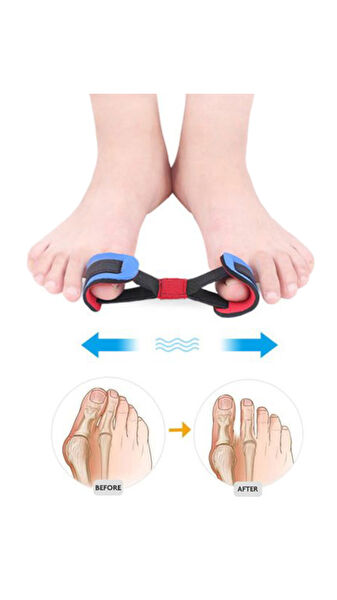 Akestoria Med Tabanlık, Koruyucu Ürünler