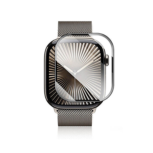 Forzacase Akıllı Saat Aksesuar