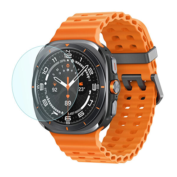 Forzacase Akıllı Saat Aksesuar