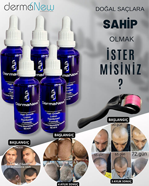 dermanewhair Saç Bakım Setleri