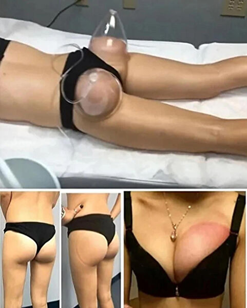 Marka Göğüs Pompası