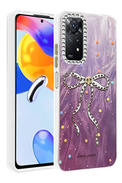 LTG Nova Cep Telefonu Aksesuar Yedek Parça